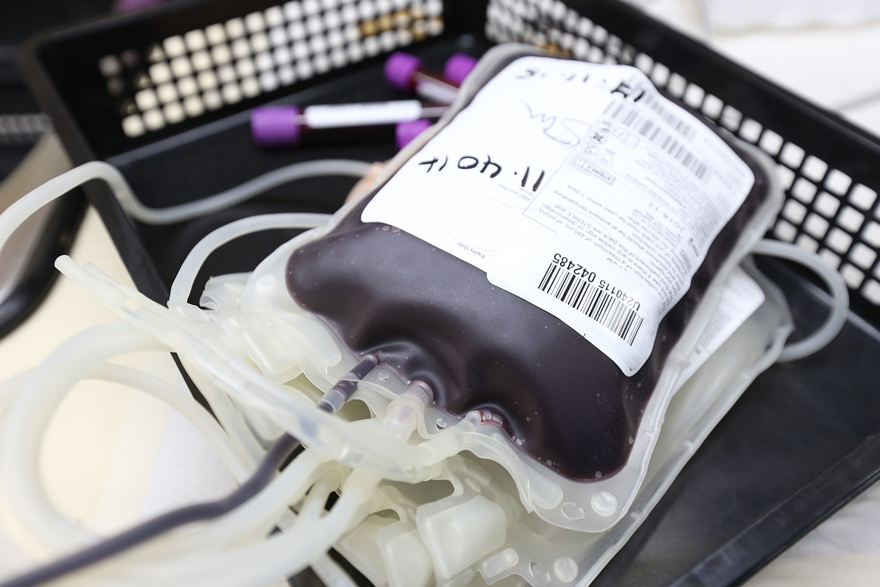 Transfuzija krvi, foto: pixabay.com 